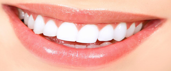 Brighten and Whiten Your Teeth with Oxygenate