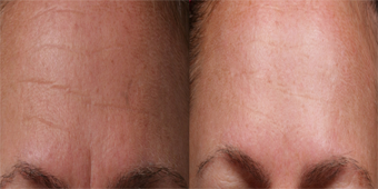 Serumax Anti Wrinkle Facial Serum men